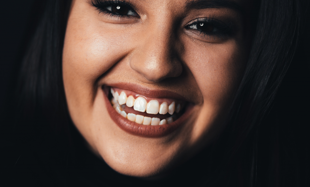 a fair-skinned woman showing her white teeth