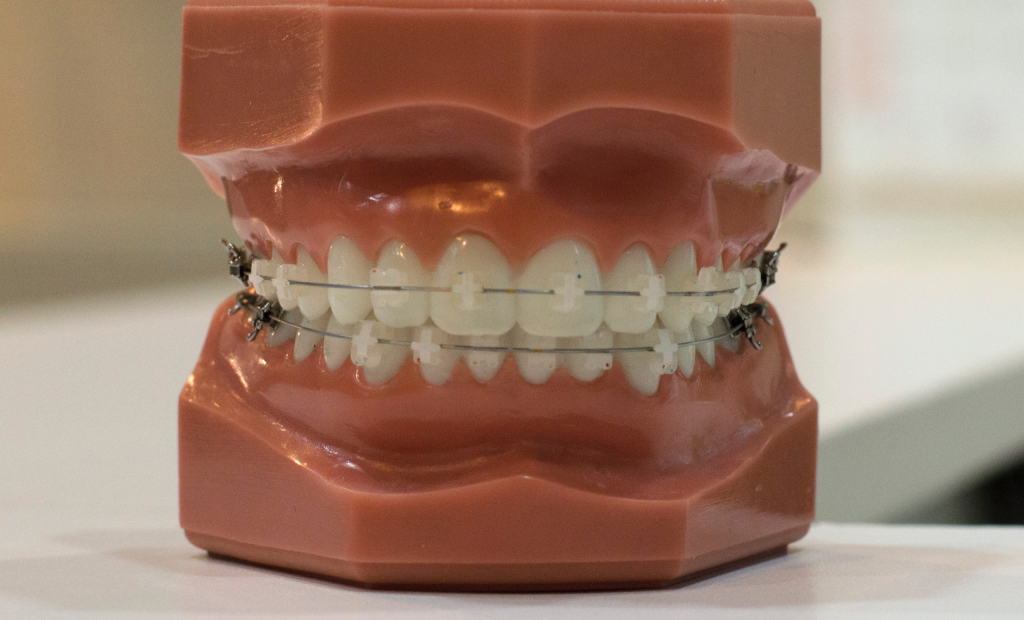 teeth model with retainer
