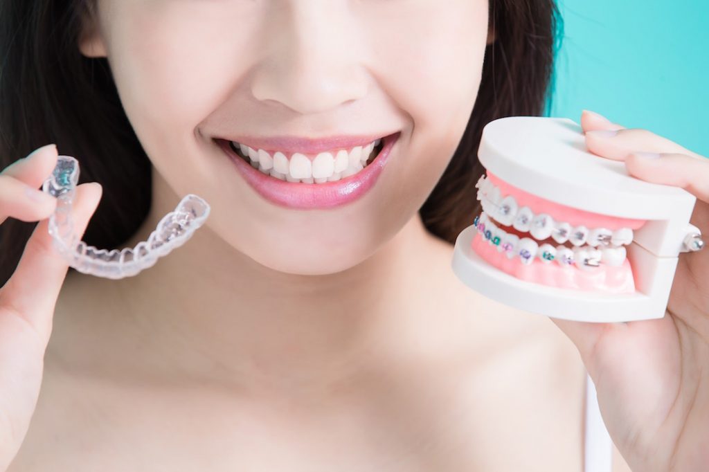 invisalign vs traditional braces