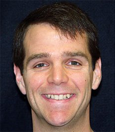 man with teeth disorder