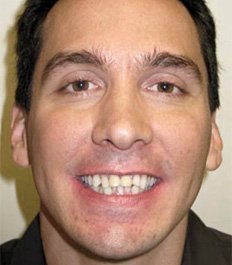 man with teeth disorder