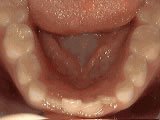lower part of teeth