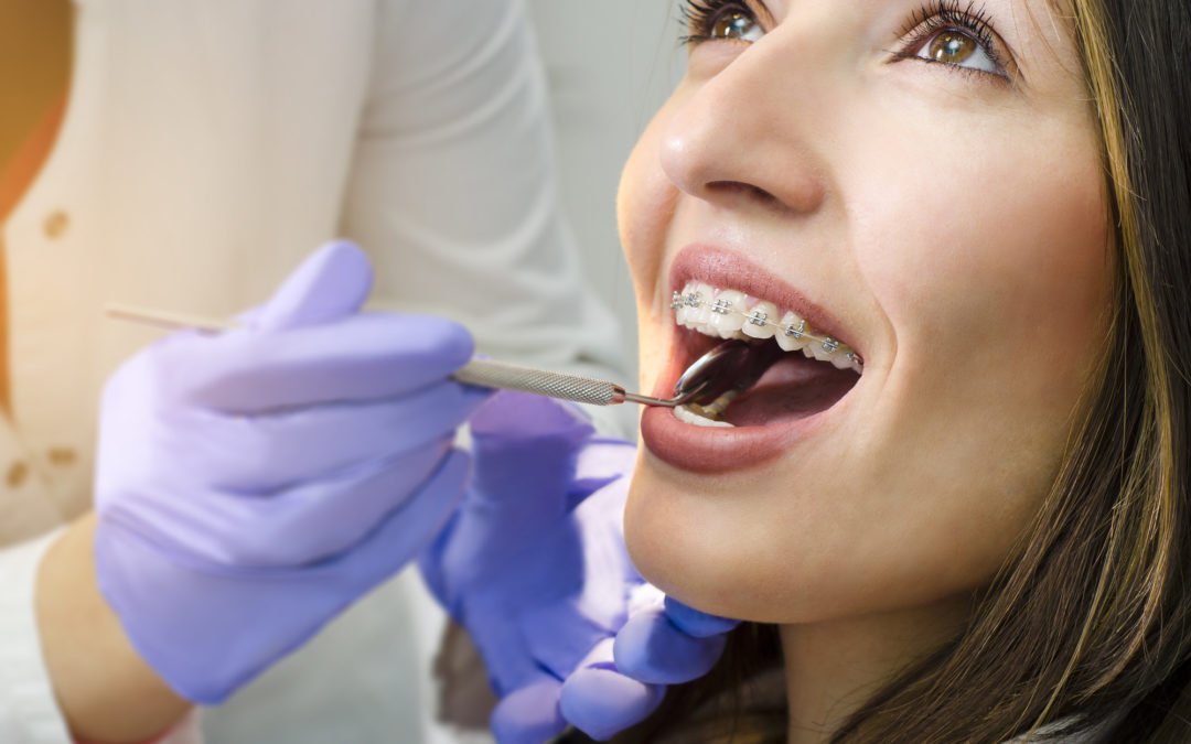 Are you ready for orthodontic treatment?