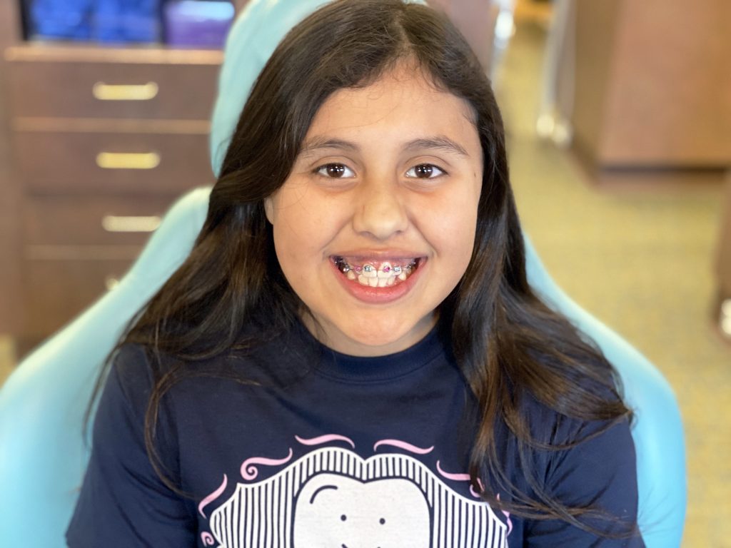 a girl showing off her teeth with braces