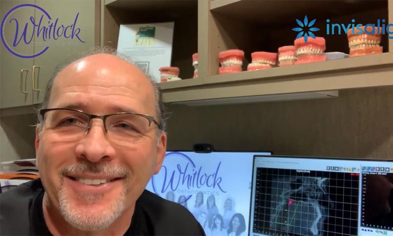 Myofunctional Therapy And Orthodontics Dr Whitlock